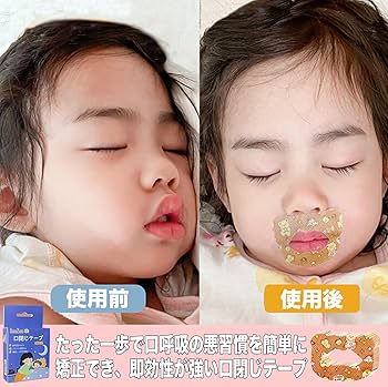 口閉じテープ Amazon.co.jp: 口閉じテープ 口呼吸防止テープ いびき防止テープ